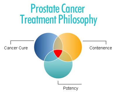 Prostate Cancer Treatment Trifecta - SMART Surgery